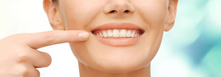 Lee más sobre el artículo Brackets estéticos: La ortodoncia que cada vez más pacientes eligen