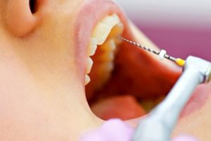 Incorporamos tecnología de última generación en tratamientos de endodoncias