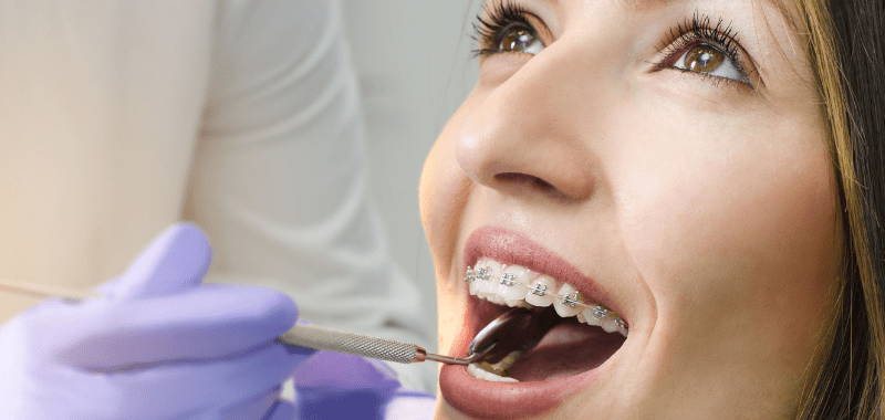 En este momento estás viendo Consejos del Dr. Nasimi sobre ortodoncia en adultos