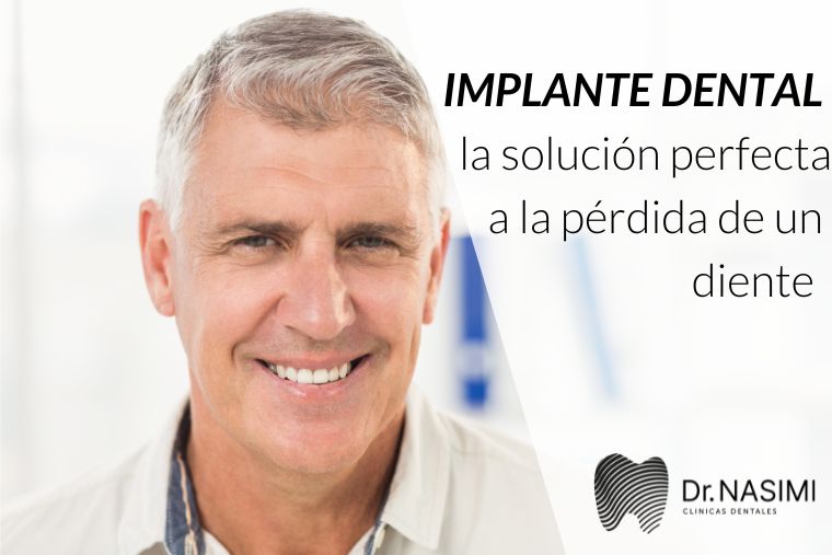 En este momento estás viendo Implante dental la solución perfecta a la pérdida de un diente