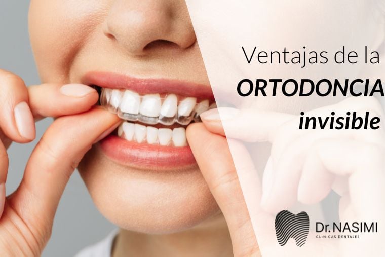 Lee más sobre el artículo Ventajas de la ortodoncia invisible