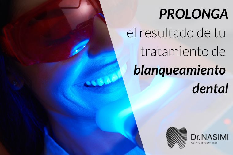 Lee más sobre el artículo Prolonga el resultado de tu tratamiento de blanqueamiento dental