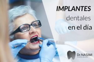 Implantes dentales en el día