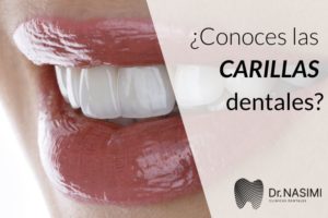 ¿Conoces las carillas dentales?
