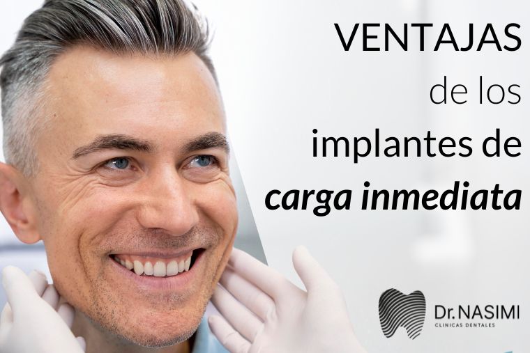 Lee más sobre el artículo Ventajas de los implantes de carga inmediata