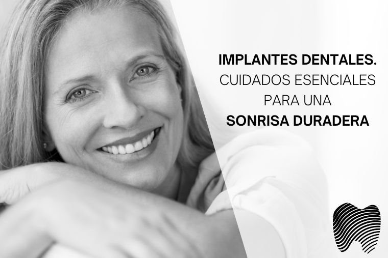 Lee más sobre el artículo Implantes dentales. Cuidados esenciales para una sonrisa duradera