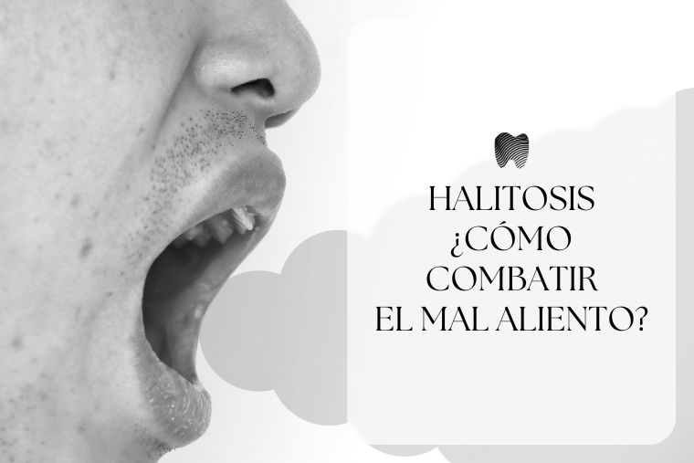 Lee más sobre el artículo Halitosis. Cómo combatir el mal aliento