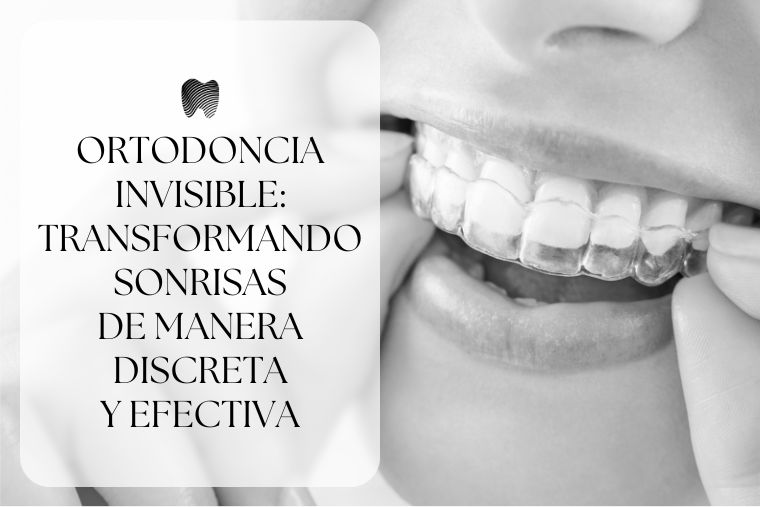 Lee más sobre el artículo Ortodoncia Invisible: Transformando sonrisas de manera discreta y efectiva