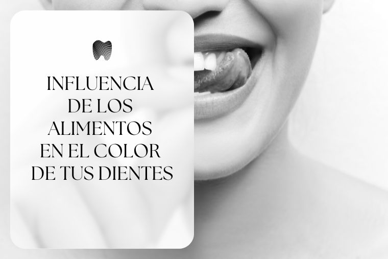 Lee más sobre el artículo Influencia de los alimentos en el color de tus dientes