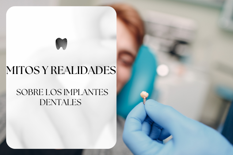 En este momento estás viendo Mitos y realidades sobre los implantes dentales