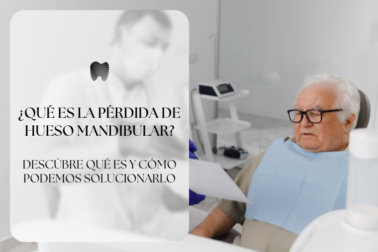 Lee más sobre el artículo ¿Qué es la pérdida de hueso mandibular?