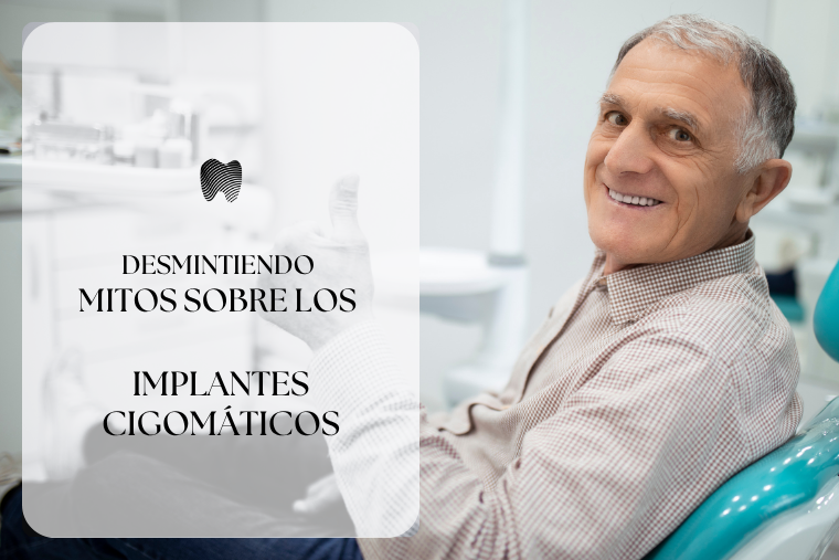 Lee más sobre el artículo Desmintiendo mitos sobre los implantes cigomáticos
