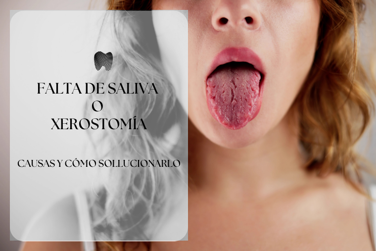 En este momento estás viendo Falta de saliva: causas, consecuencias y cómo combatir la sequedad bucal