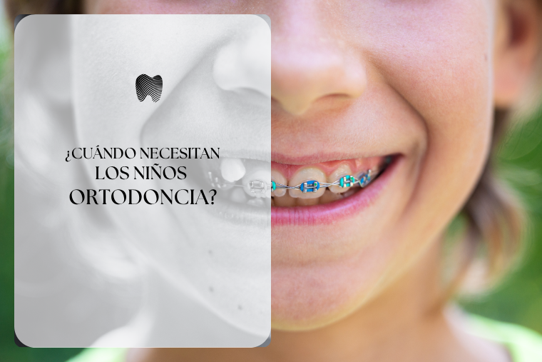 Lee más sobre el artículo ¿Cuándo necesitan los niños ortodoncia?