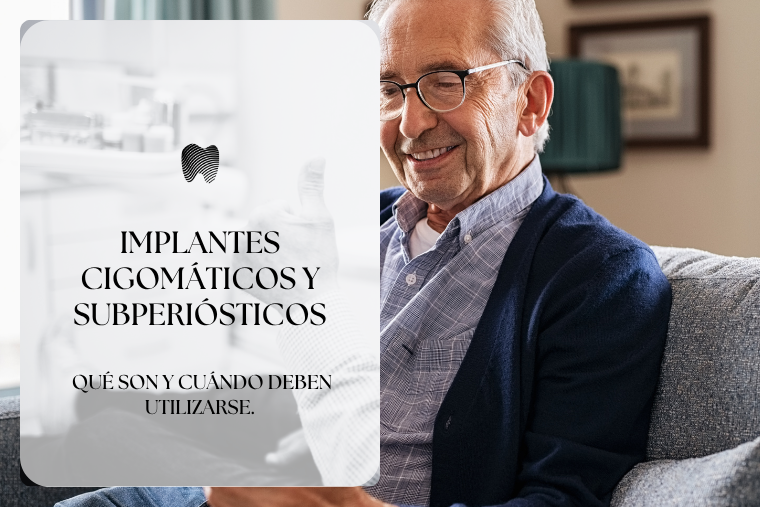 Lee más sobre el artículo Implantes cigomáticos y subperiósticos: qué son y cuándo deben utilizarse.