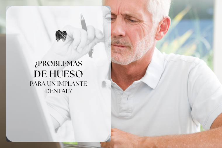 Lee más sobre el artículo ¿Problemas de hueso para un implante dental?