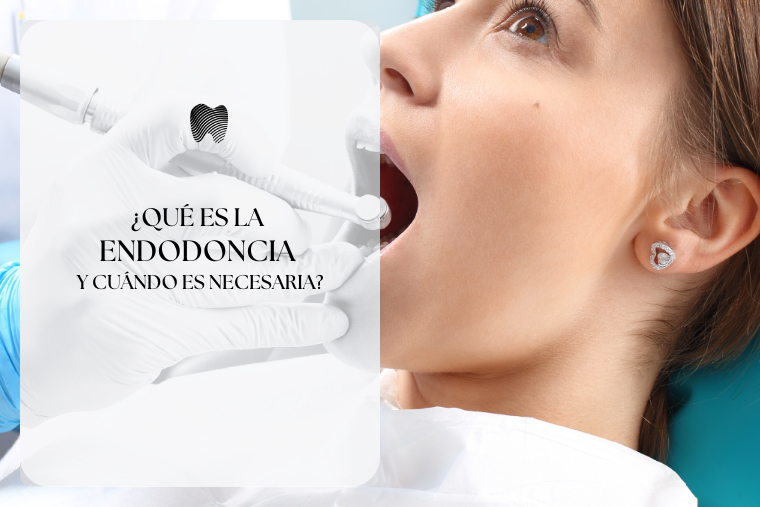 Lee más sobre el artículo ¿Qué es la Endodoncia y cuándo es necesaria?