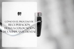 proceso recuperación implante dental