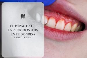 Periodontitis y salud general