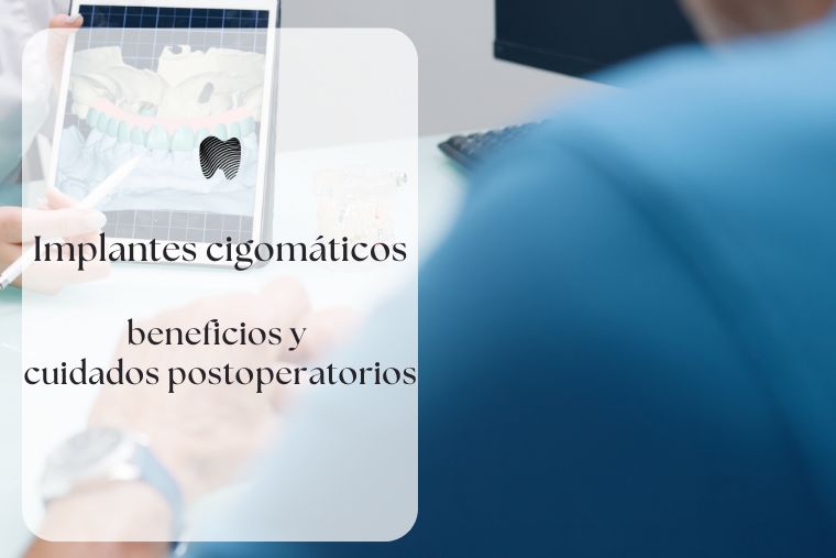 Lee más sobre el artículo Implantes cigomáticos: Beneficios y cuidados postoperatorios