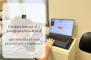 Escáner intraoral o fotogrametría dental: qué sistema es más preciso para implantes